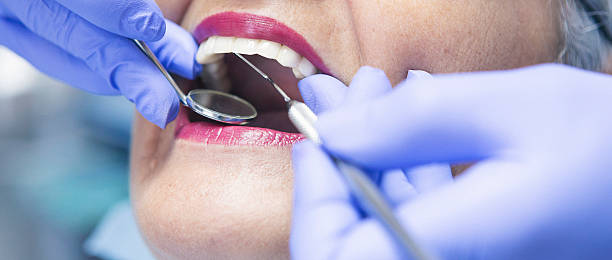 Best Emergency Root Canal Treatment in Garden City, MI